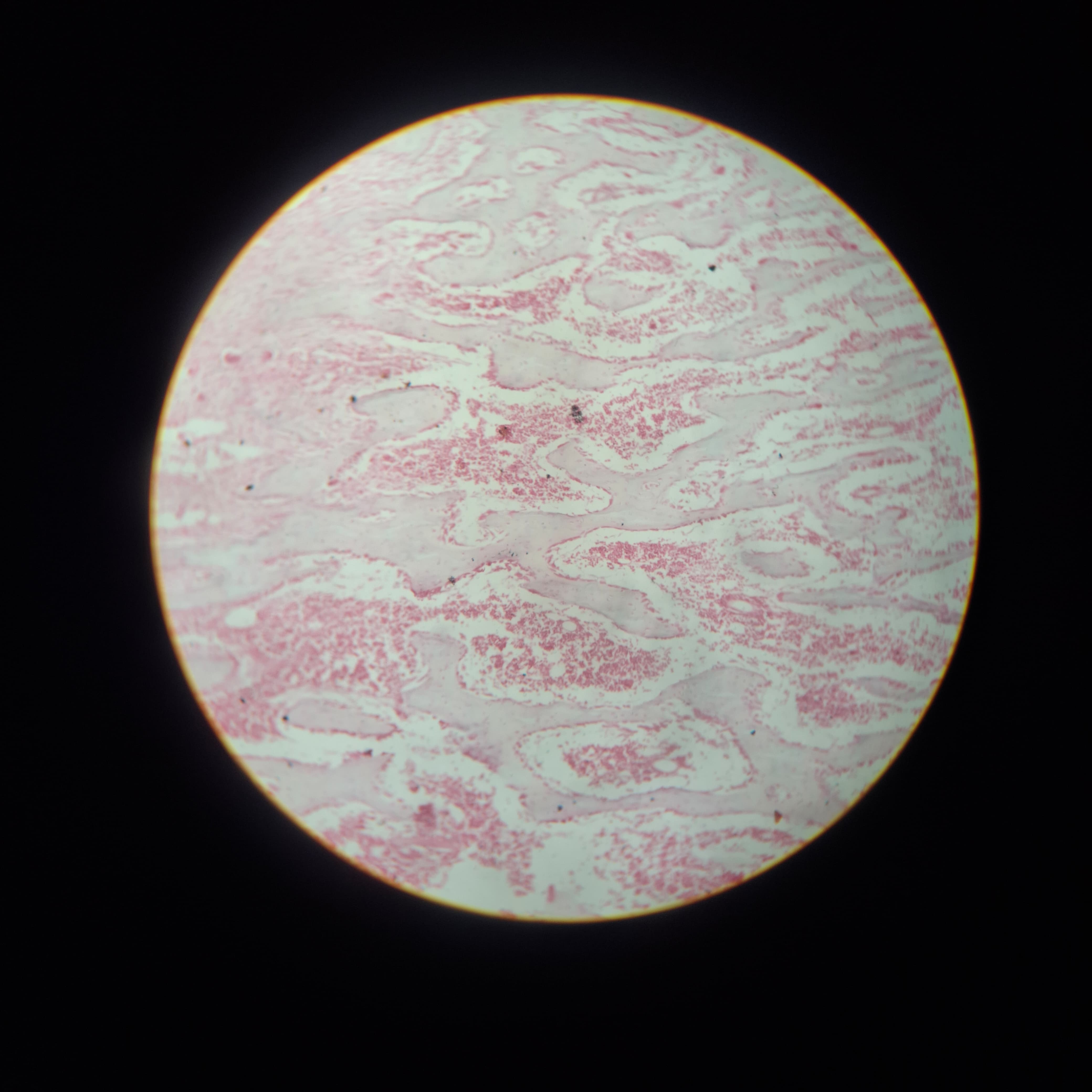 Spongy Bone